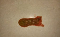 细小的症状有哪些表现