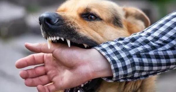 养狗的人不怕狂犬病吗-图1