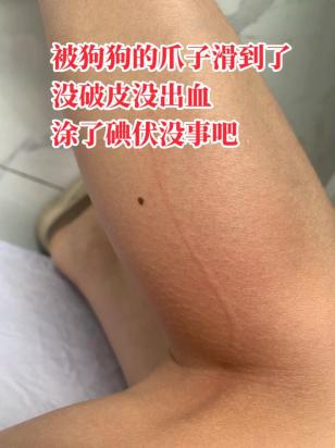 被自己家的狗爪子抓破了一点点皮-图1