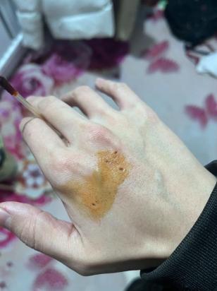 猫被咬了化脓个小洞怎么办-图1